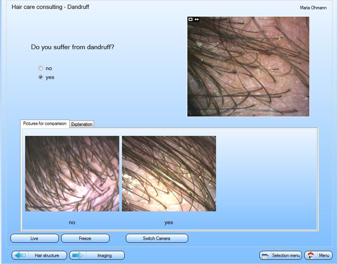 camera supported questions about hair and scalp