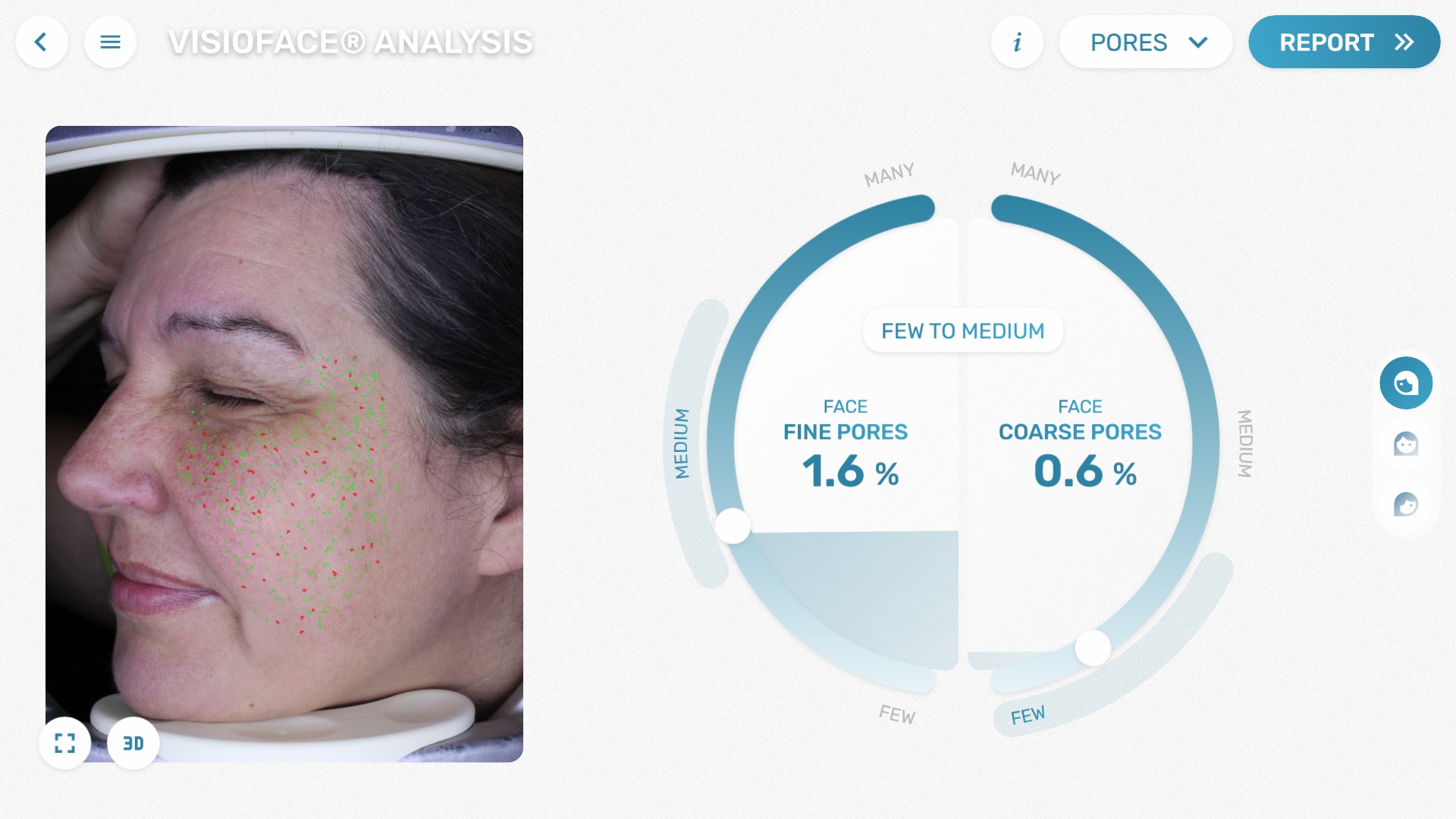 VisioFace® - see fine and coarse pores in the image