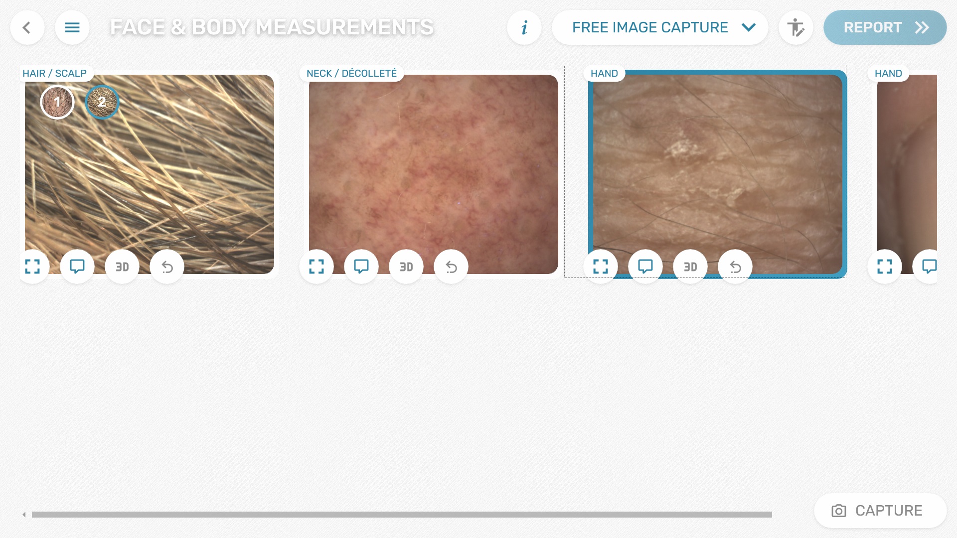 No limits to the Visioscope®: hair, scalp, hand, nail, décolleté and more