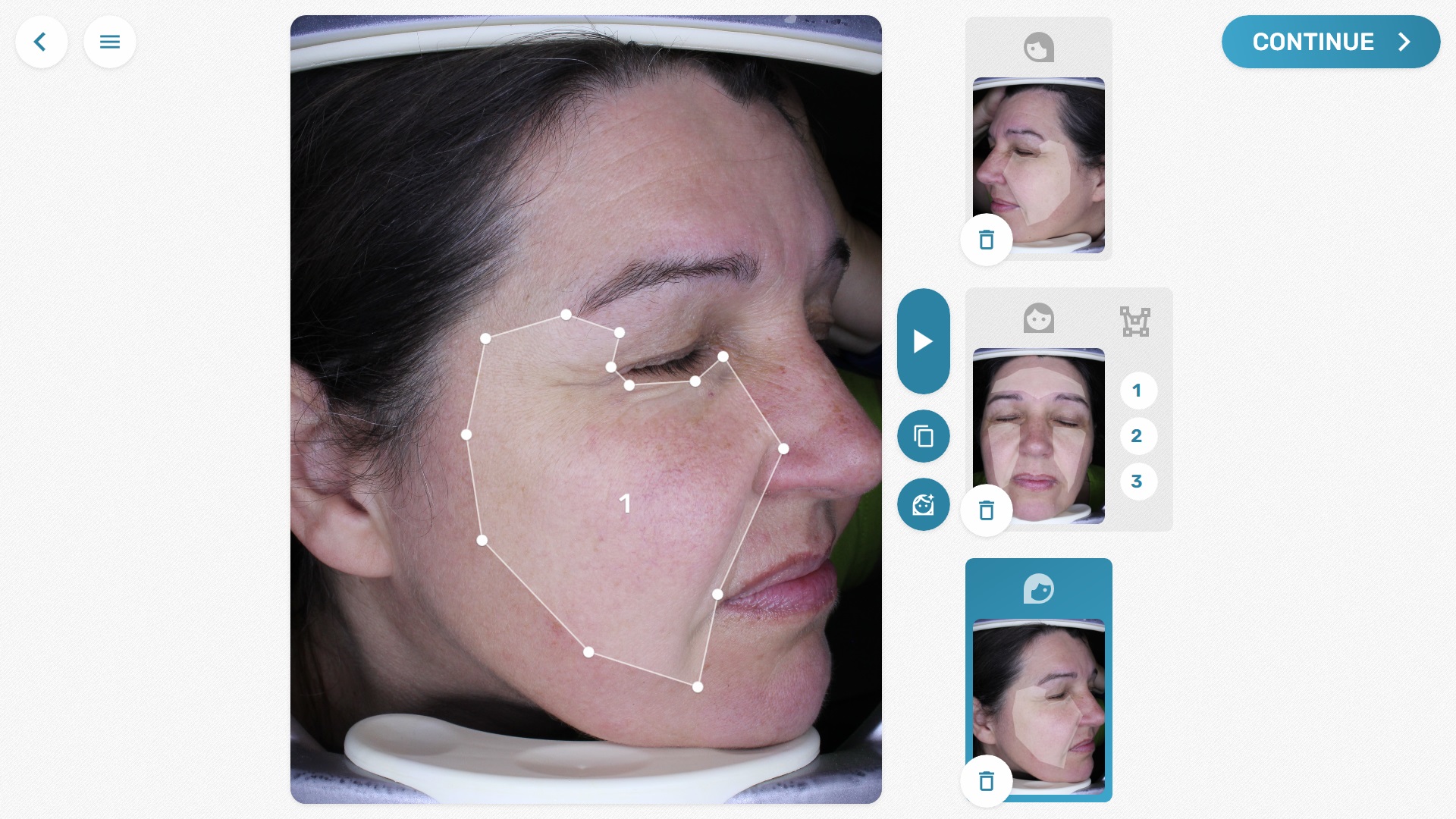VisioFace® automatic face recognition will position ROI automatically